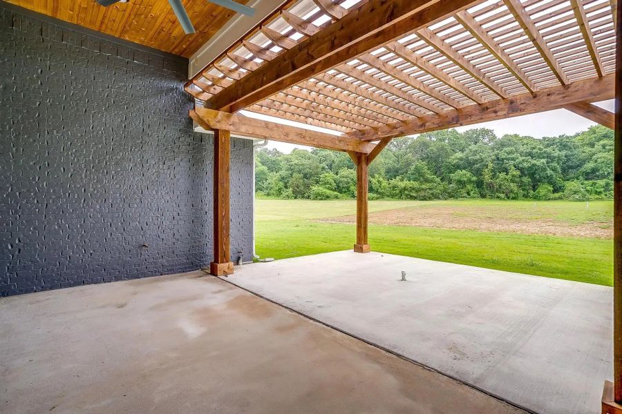Representative exterior details of a home built from the The Avery by Elmwood Custom Homes in Aledo Heights, Aledo (Image 15).