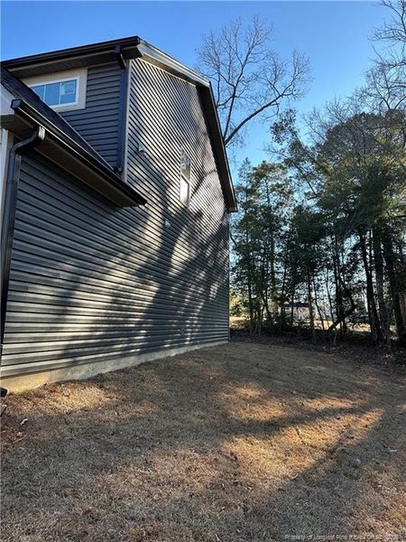 Right side Right side