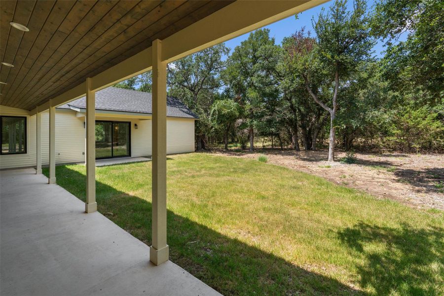 A spacious covered patio overlooks a generous lawn, flowing into a natural, wooded landscape.