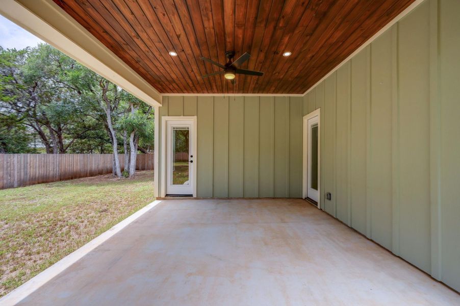 A spacious covered patio invites outdoor enjoyment with a warm wood plank ceiling. A spacious covered patio invites outdoor enjoyment with a warm wood plank ceiling.